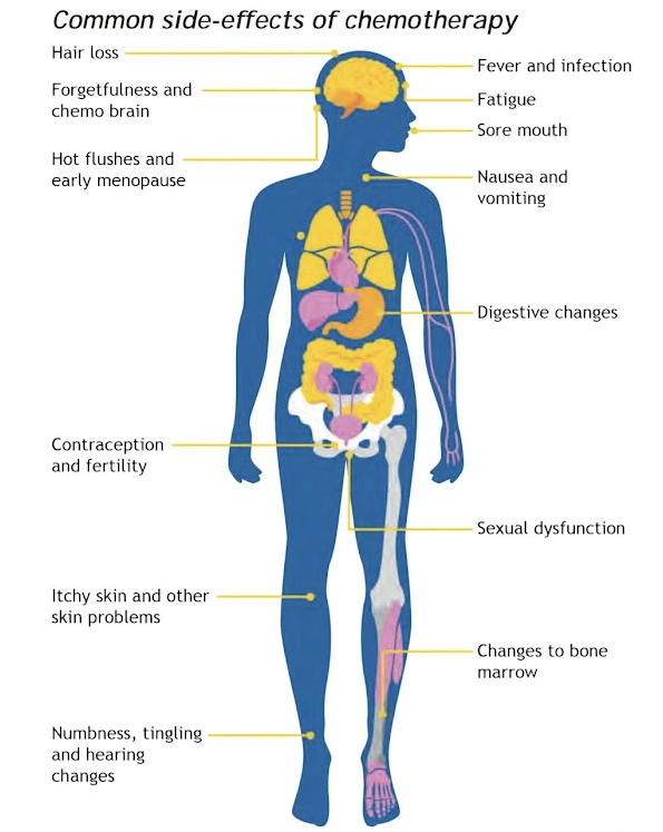 Chemotherapy chart